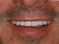 Konig Center for Cosmetic & Comprehensive Dentistry smile photos